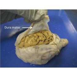 Sheep brain with dura mater